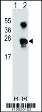 AP2785A - Размер : 100 микрограма - Заешки поликлональные антитела срещу GADD45A - Всяка